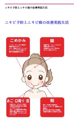美肌の森の「ニキビケアのまとめレポート」プレゼント