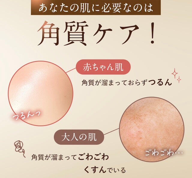 角質ケアが必要